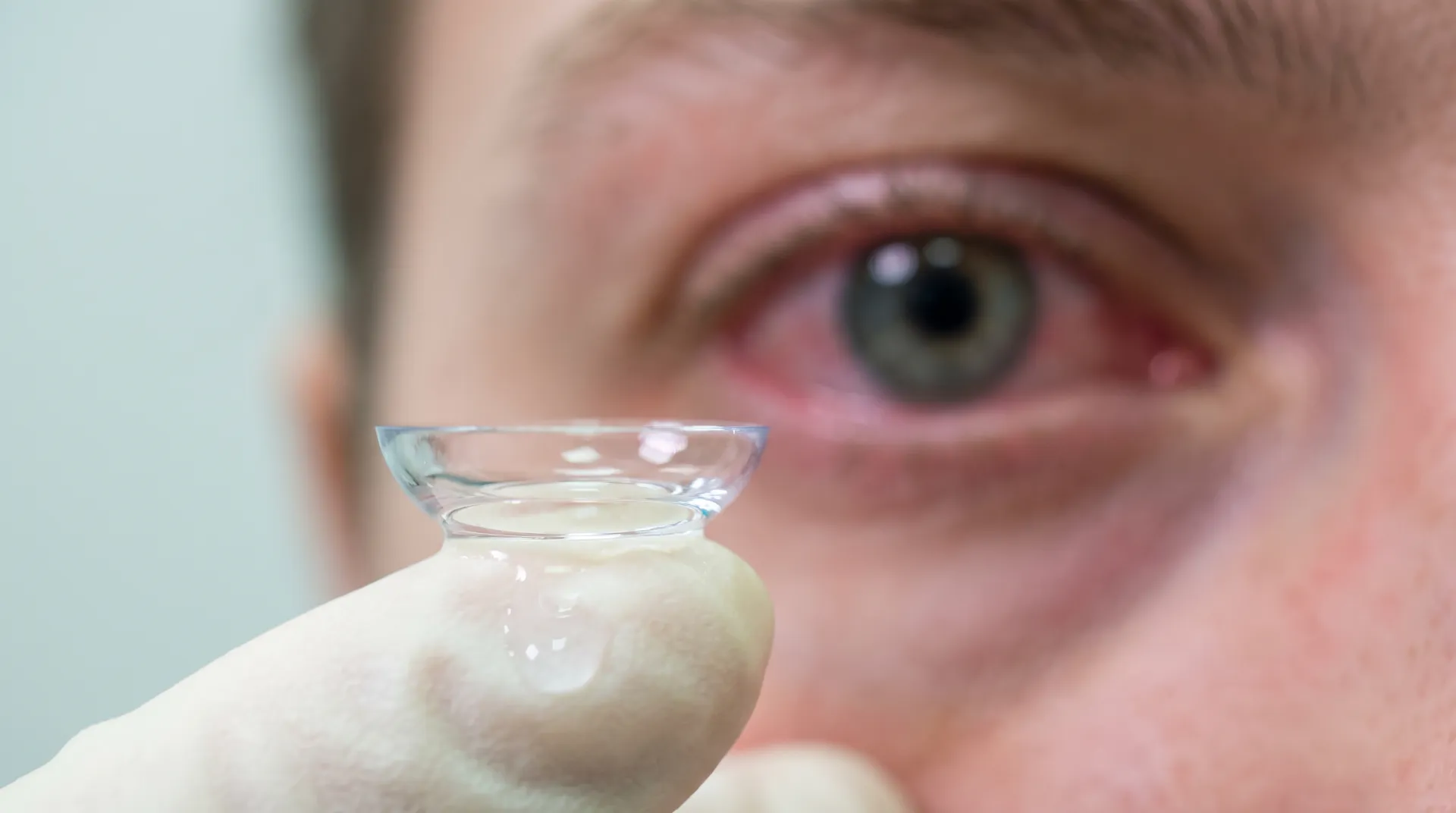 Keratoconus specialist Dr. Bonakdar — Bascom Palmer trained, Orange County